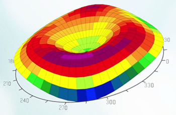 近視矯正?？?/>
      <div   id=
